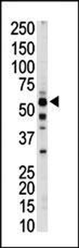 PKLR Antibody (C-term)