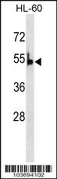 PKLR Antibody (C-term)