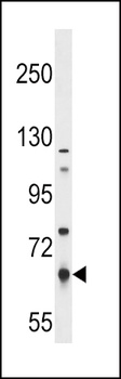 PKLR Antibody (N-term)