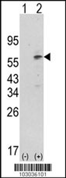 PDK1 Antibody (N-term)