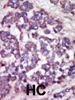 LATS1 Antibody (N-term)
