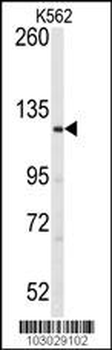 LATS1 Antibody (N-term)