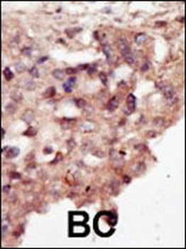 DAPK2 Antibody (N-term)