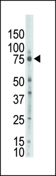 PKC zeta Antibody (N-term)
