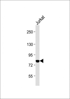 PKC theta Antibody (C-term)