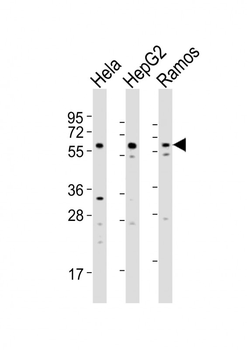 GRK5 Antibody (C-term)
