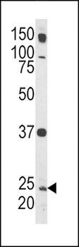Rab5 Antibody (C-term)