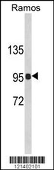 CR2 Antibody (C-term)