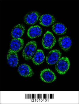 TPH1 Antibody (N-term)