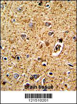 TPH1 Antibody (N-term)