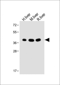 OTC Antibody (Center)