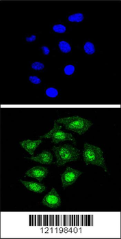 CBFB Antibody (Center)