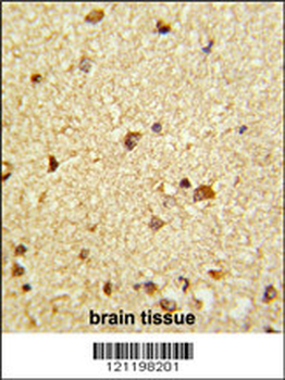 CBFB Antibody (Center)