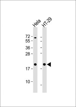 FTH1 Antibody (C-term)