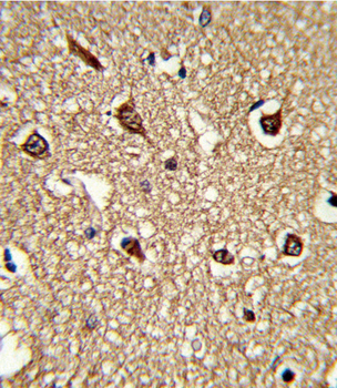 HLA-DRB1 Antibody (N-term)