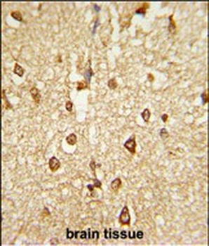 DLX2 Antibody (Center)