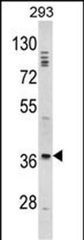 DLX2 Antibody (Center)