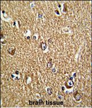 FMR1 Antibody (N-term)