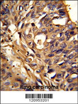 ETFDH Antibody (N-term)