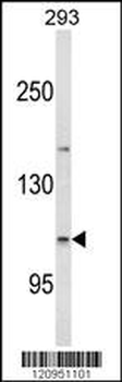 ESPN Antibody (N-term)