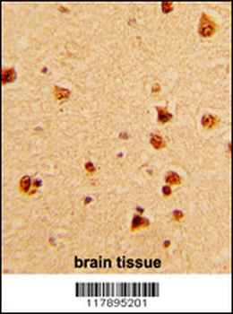 KHSRP Antibody (N-term)