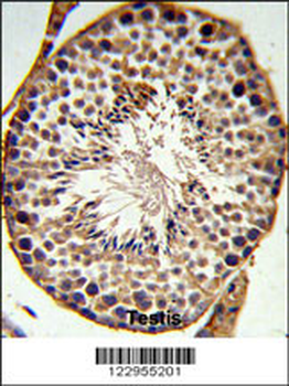 SFRS1 Antibody (N-term)
