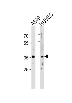 HOXB5 Antibody (C-term)