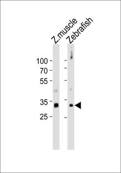 HOXB5 Antibody (C-term)