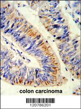RELA Antibody (N-term)