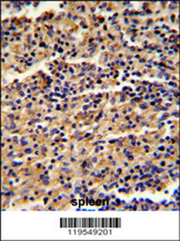 ALKBH8 Antibody (C-term)