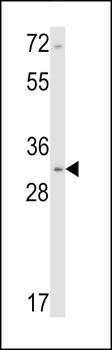 Calponin-1 Antibody (N-term)
