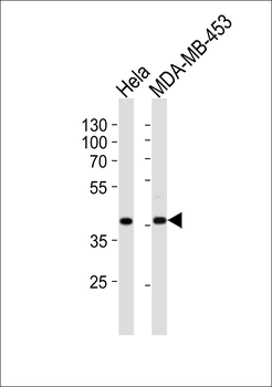 Calponin-1 Antibody (N-term)