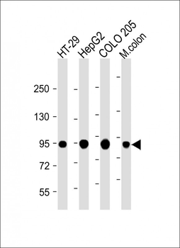 Villin-1 Antibody (N-term)