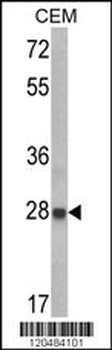 IGFBP6 Antibody (C-term)
