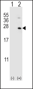 HPRT1 Antibody (C-term)