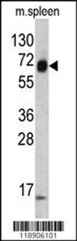 KRT4 Antibody (C-term)