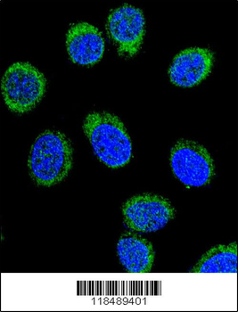 SERPINC1 Antibody (C-term)