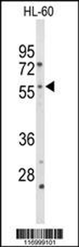 CYP2C19 Antibody (N-term)