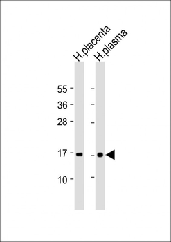 TTR Antibody (C-term)