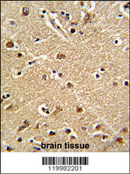 ZWINT Antibody (Center)