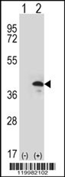 ZWINT Antibody (Center)