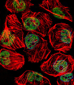 TBP Antibody (Center)