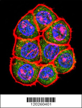 TBP Antibody (C-term)