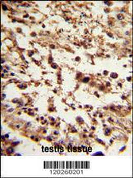 TBP Antibody (C-term)