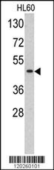 TBP Antibody (C-term)