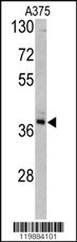 TALDO1 Antibody (Center)