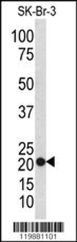 TAGLN Antibody (N-term)