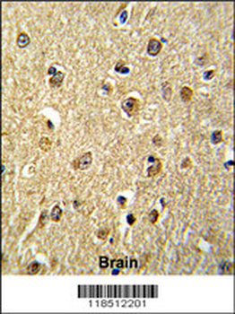 NKRF Antibody (Center)