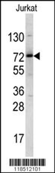 NKRF Antibody (Center)
