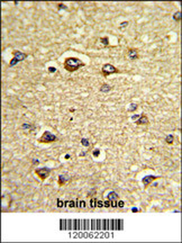 GAS7 Antibody (C-term)